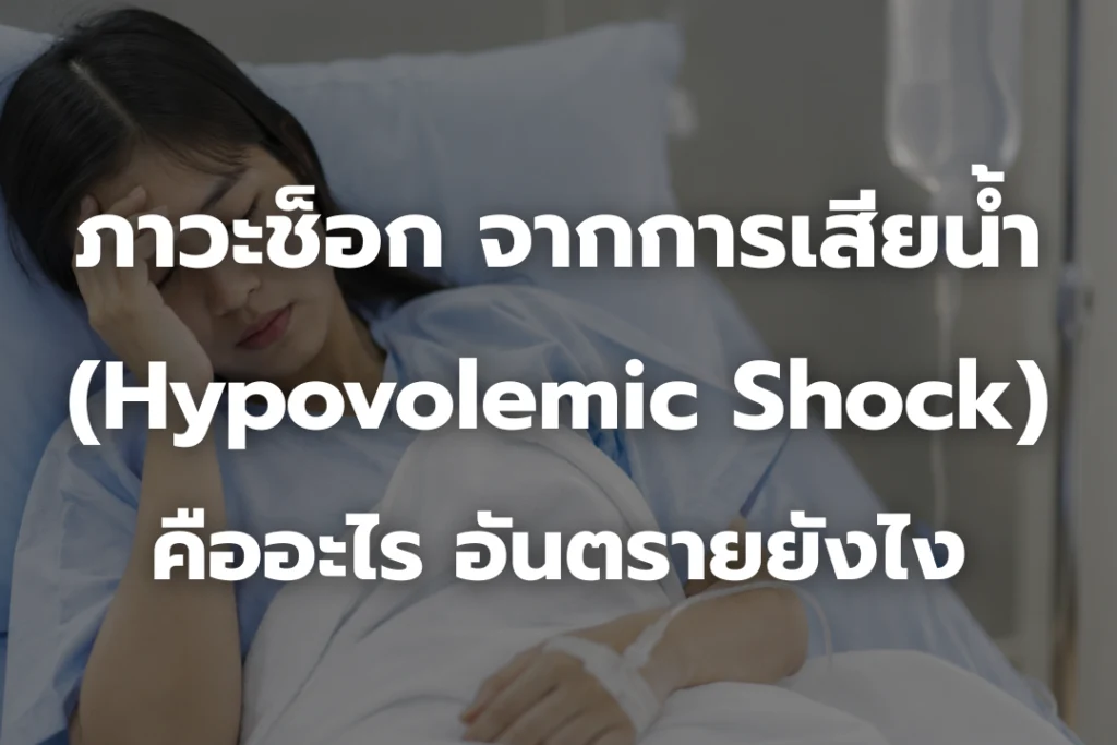 ภาวะช็อก จากการเสียน้ำ (Hypovolemic Shock) คืออะไร